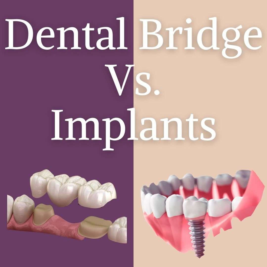 dental-implants-hartsdale