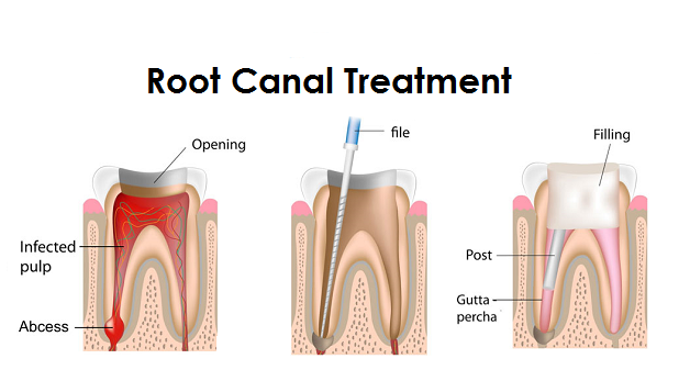 endodontist scarsdale